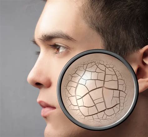 problem skin images search images  everypixel