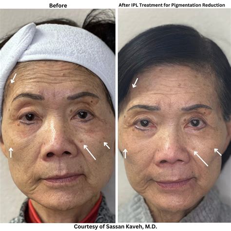 Alpha Medical Aesthetics - Medical Spa - Las Vegas, NV