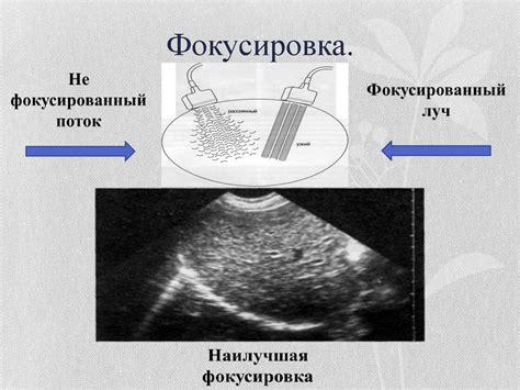Ультразвук в медицине - презентация онлайн
