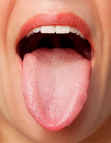 The Tongue: A Window to Your Health - What Your Tongue Reveals About ...