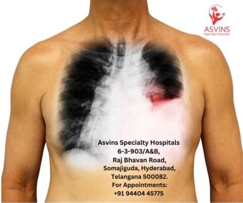 Unveiling Lung Cancer Symptoms That Manifest on the Skin - Asvins ...