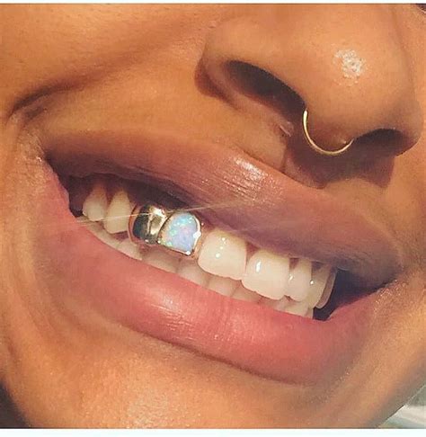How To Take Out Permanent Gold Teeth - Katie Washington Hochzeitstorte