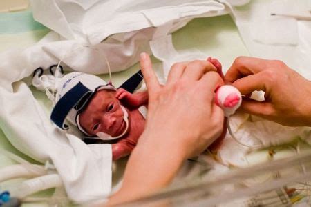 Baby born at 22 weeks survives against the odds - News