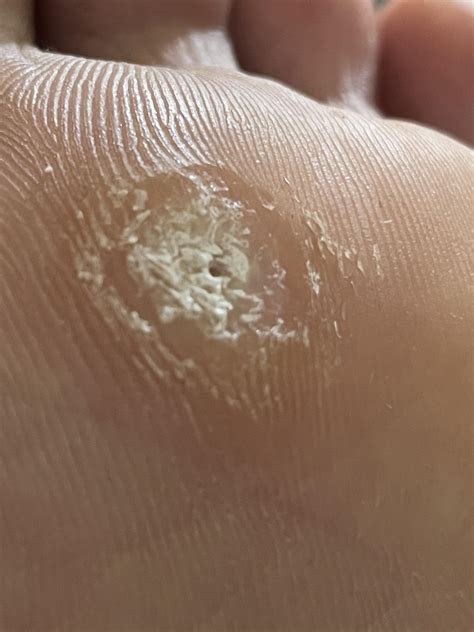 Ginger On Bottom Of Feet For Sleep at John Castellanos blog