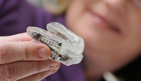 For Sleep Apnea, a Mouth Guard May Be a Good Alternative to CPAP - The ...