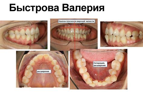 Стоматология. Клинический случай - презентация онлайн