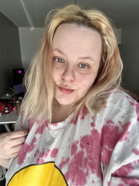 I dont know what to do with my face. I have scars all over, pimples and