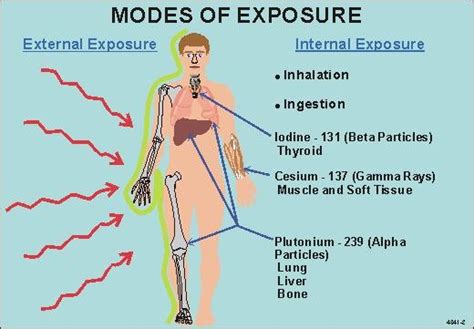 How the hell should I know?: Symptoms of radiation sickness...