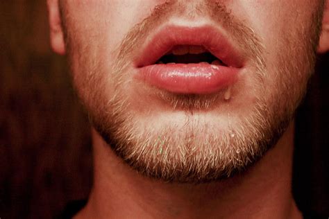 Canker Sore On The Tongue: Causes, Symptoms, and Remedies 2020
