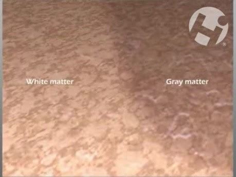 neurology training courses cases join medtube   page