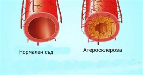 Истината за холестерола, която фармацевтичните компании крият от нас и ...