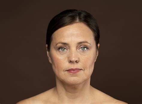 Eczema Numular: Causas, Sintomas e Possíveis Tratamentos
