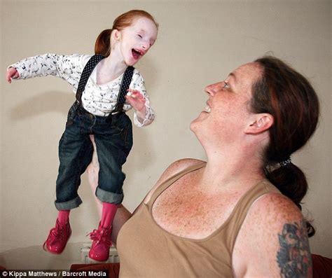 Awe-Inspiring Story of Charlotte Garside, World's Smallest Baby Girl ...