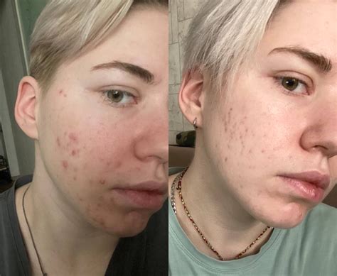 Openface | Skincare & body products