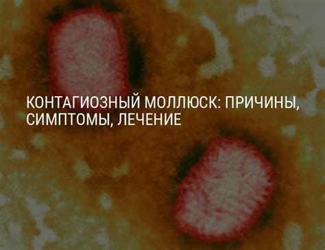Контагиозный моллюск: фото, симптомы, лечение в домашних условиях ...