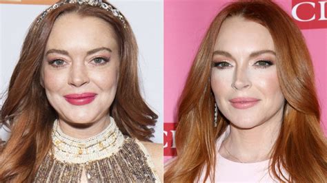 Plastic Surgeon Tells Us What's Behind Lindsay Lohan's Dramatic ...