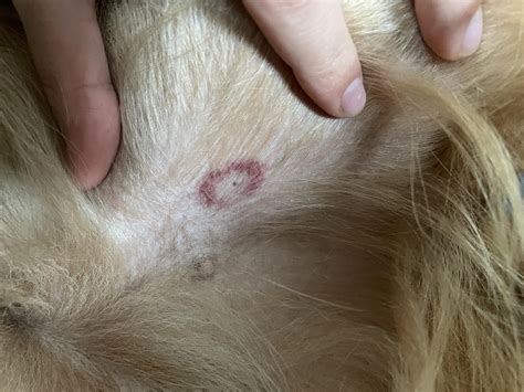 How long does a tick need to bite tp transmit lyme? : r/Lyme