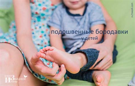 Подошвенная бородавка. Бородавки на ногах и стопе. Фото. Лечение