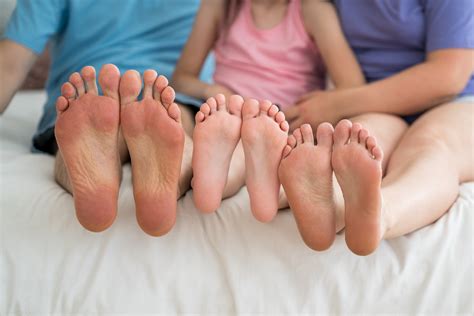 What Is A Corn On Foot: Symptoms & Treatments