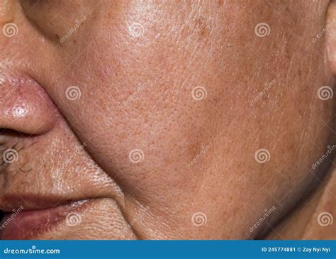 Что такое поры на лице? Узнайте их особенности и как справиться с ...