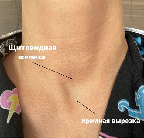 Щитовидная железа - где находится и ее строение? | Хирург-эндокринолог ...
