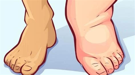 how to get thinner ankles