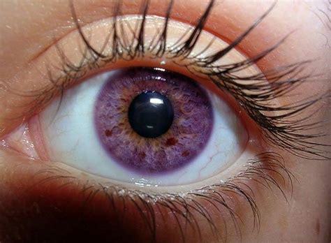 Violet Eyes Rare