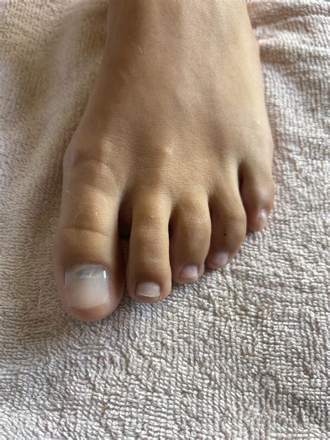 Professional Podiatry Services | Sports Medicine Clinic Parramatta