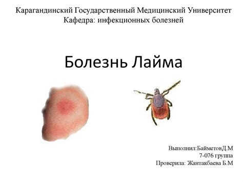 Болезнь Лайма - презентация онлайн