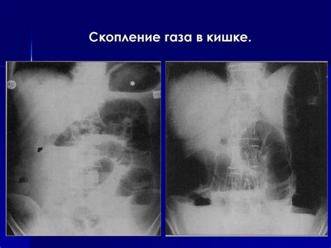 Рентгеносемиотика заболеваний ЖКТ - презентация онлайн