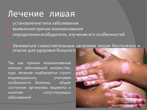 Опоясывающий лишай: фото, симптомы и лечение у взрослых