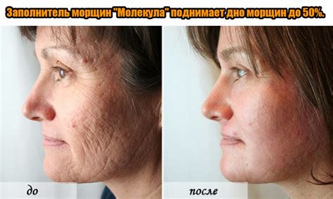 Пилинг ретинол: Ретиноловый пилинг BIOMATRIX RETINOL CREAM PEEL от ...