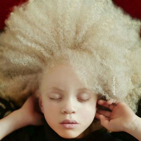 58 Albino People Who'll Mesmerize You With Their Beauty | Bored Panda