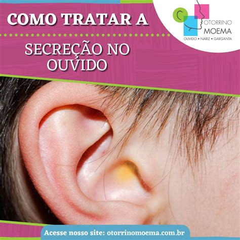 Secreção Saindo Do Ouvido - Otorrino Moema - ♦️A secreção no ouvido pode ter...