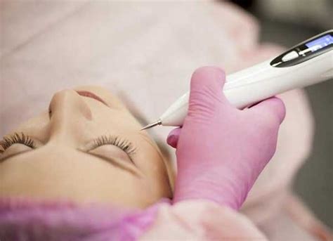 Jato de Plasma: Como Funciona? Quem Pode Fazer? Como é Feito?
