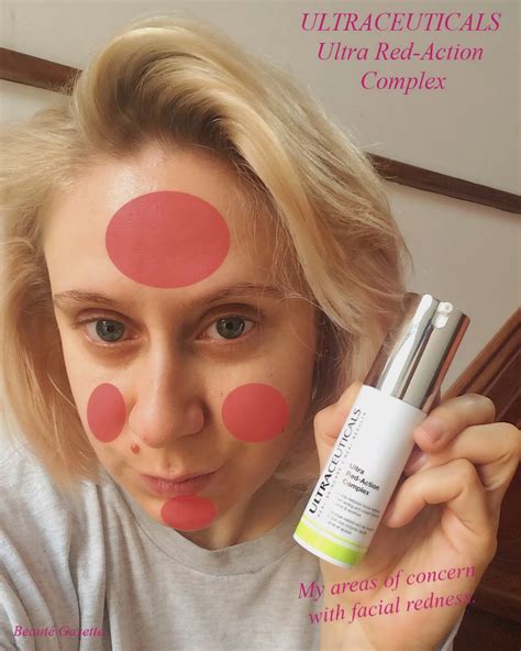 Beauté Gazette: Ultraceuticals Ultra Red-Action Complex - My 90 day ...