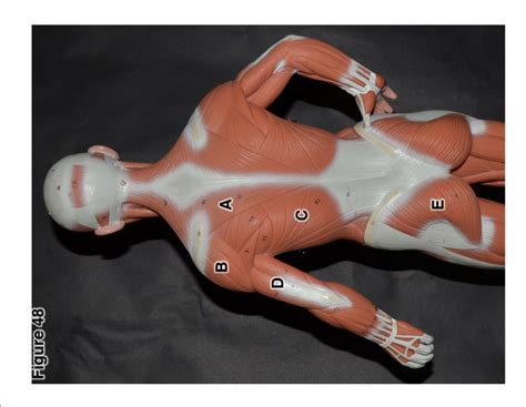 figure  posterior body diagram quizlet