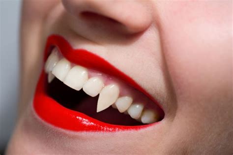 Vampire Teeth Implants Price