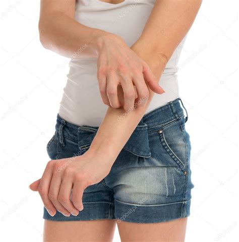 Jonge vrouw allergie haar arm krassen — Stockfoto © dml5050 #50820179