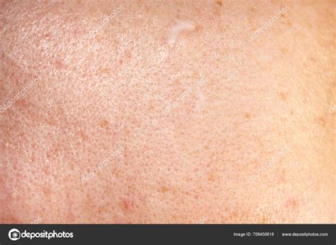 skin texture scar close stock photo human skin  quality stock