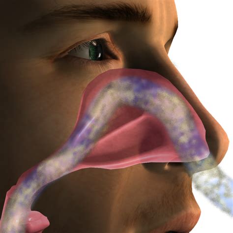 Lavagem Nasal: Como Fazer De Forma Segura E Eficaz
