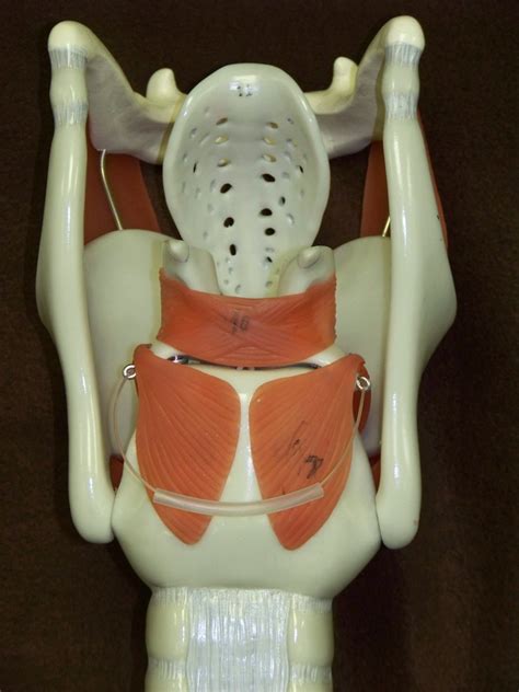 Thyroid Cartilage 2 Diagram | Quizlet