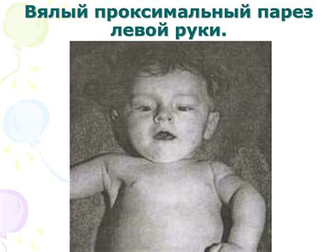 Причины и клинические синдромы перинатального поражения нервной системы ...