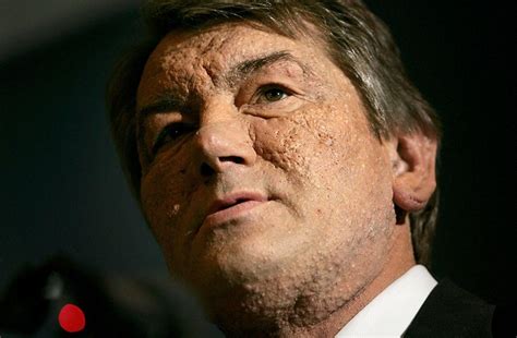 Почти президент Ющенко. Чем закончилась история самого громкого ...
