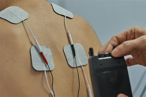 Transcutaneous Electrical Nerve Stimulation (TENS) - A Canadian Primer ...