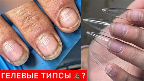 МОЕ МНЕНИЕ О ГЕЛЕВЫХ ТИПСАХ - YouTube