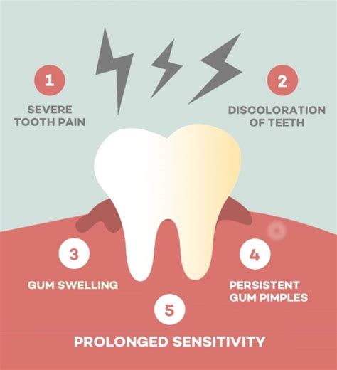What Are The Signs And Symptoms Of Tooth Needing Root Canal Treatment ...