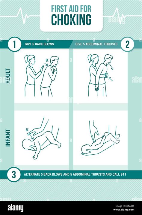 First aid procedure for choking and heimlich maneuver for adults and ...
