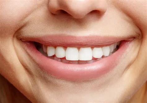 front teeth  wide   depth