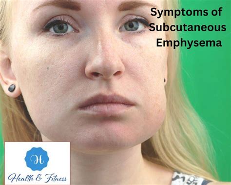 Subcutaneous Emphysema: Causes, Symptoms, And Treatment Options